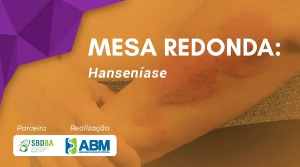 Assista a Mesa Redonda “Hanseníase